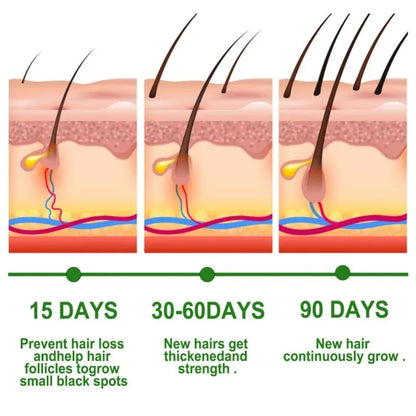 Sérum croissance capillaire soin cheveux femme